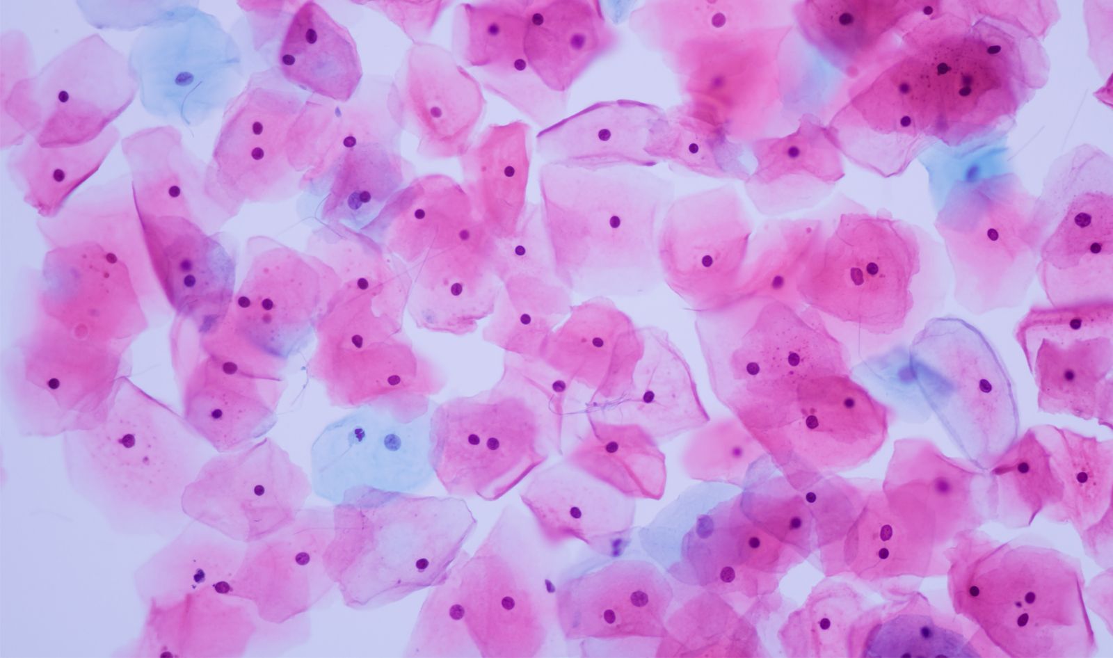 Oncology applications